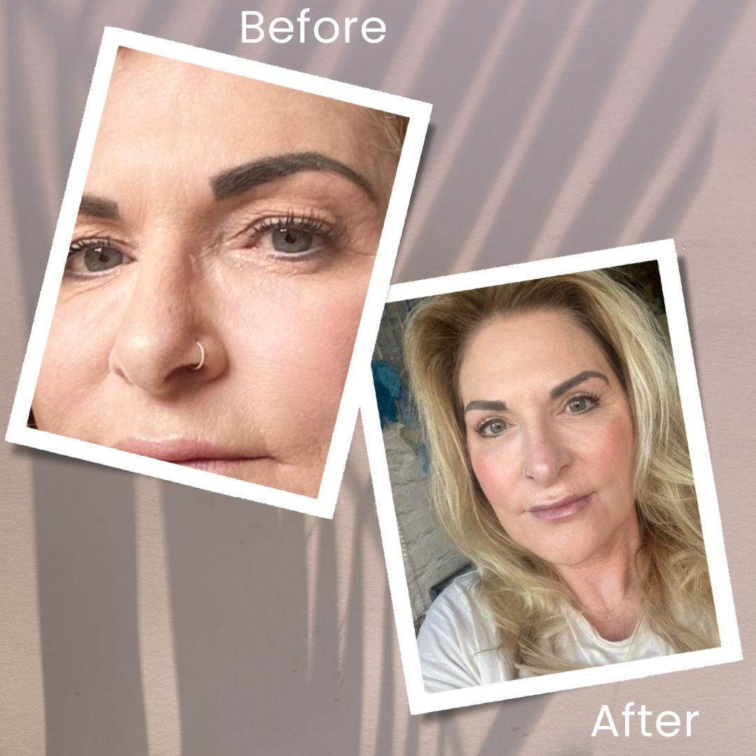 Katy before and after surgery